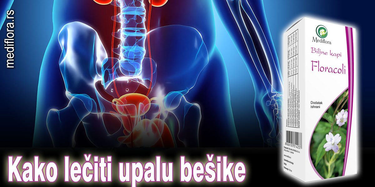 Kako-lečiti-upalu-bešike Kako lečiti upalu bešike