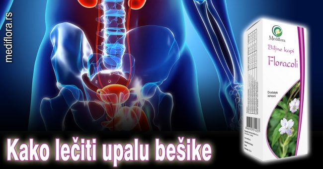 Kako-lečiti-upalu-bešike Kako lečiti upalu bešike