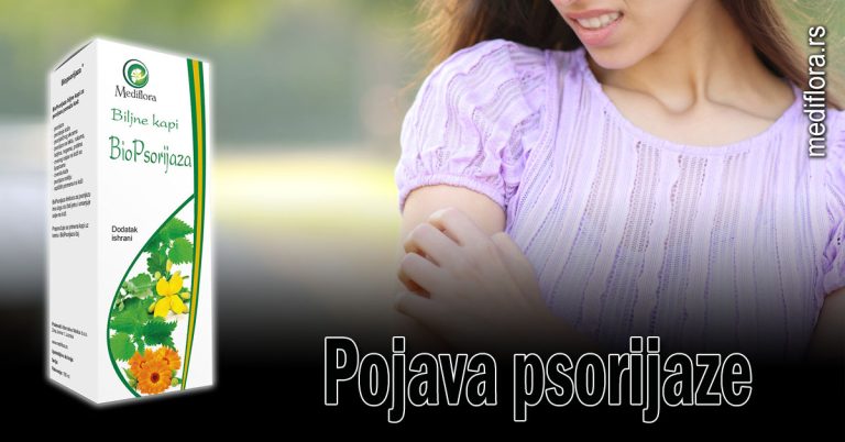 Pojava-psorijaze Pojava psorijaze