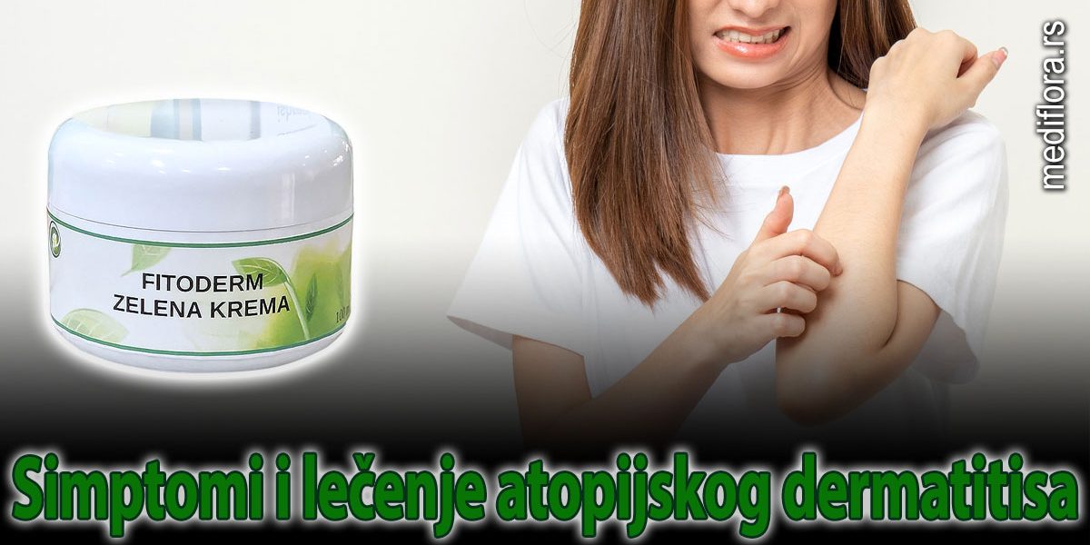 Simptomi i lečenje atopijskog dermatitisa