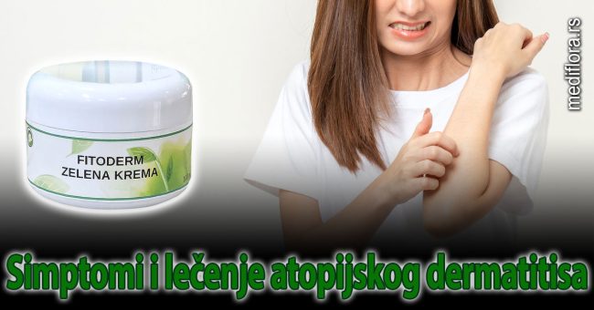 Simptomi i lečenje atopijskog dermatitisa