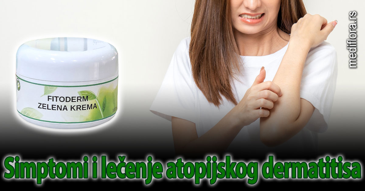 Simptomi i lečenje atopijskog dermatitisa - Mediflora