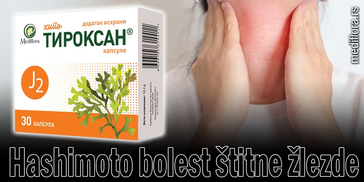 Hashimoto-bolest-štitne-žlezde Hashimoto bolest štitne žlezde