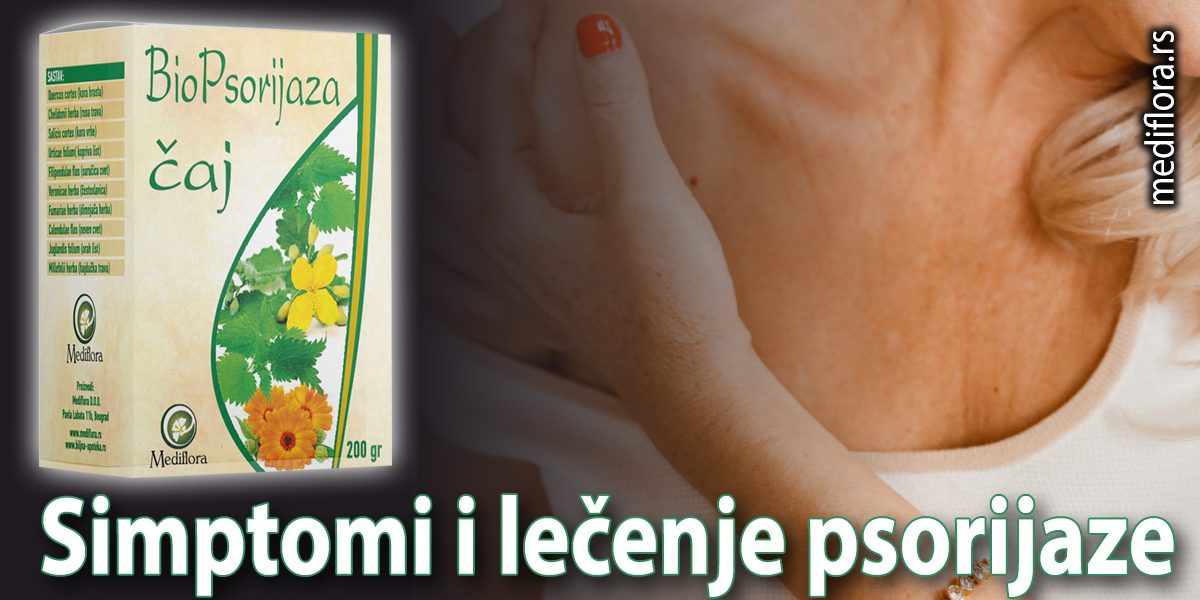 Simptomi i lečenje psorijaze