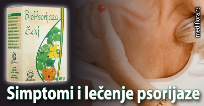 Simptomi i lečenje psorijaze
