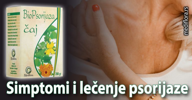 Simptomi i lečenje psorijaze