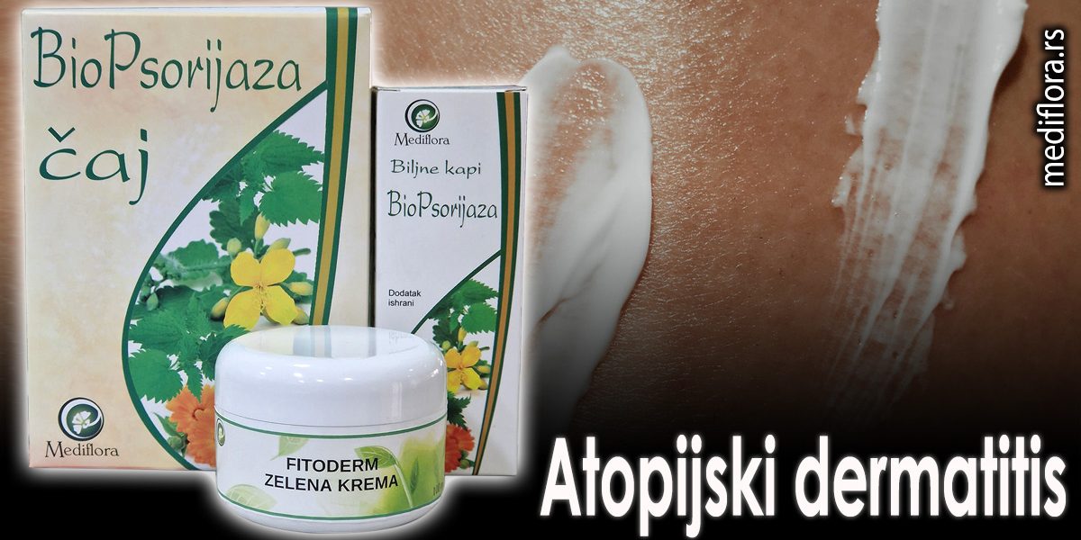 Atopijski-dermatitis Atopijski dermatitis