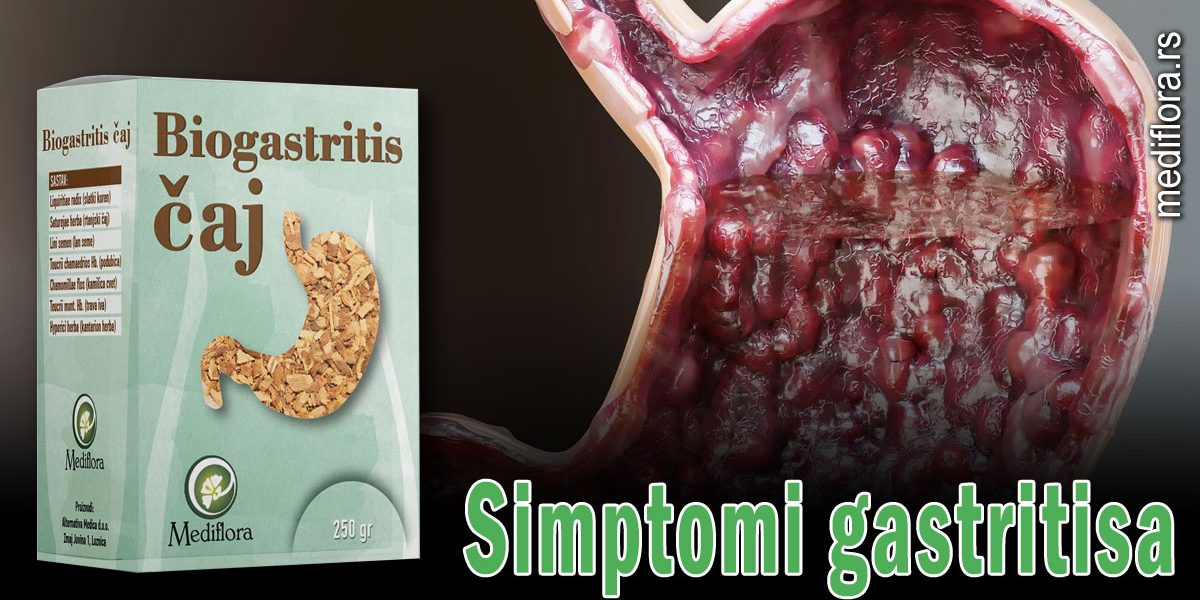 Simptomi-gastritisa Simptomi gastritisa