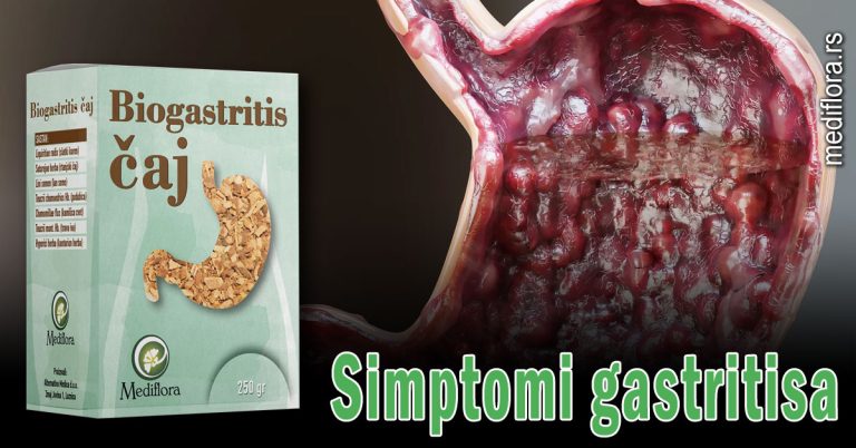 Simptomi-gastritisa Simptomi gastritisa