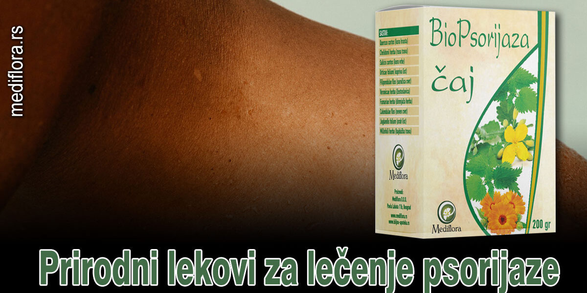 Prirodni-lekovi-za-lečenje-psorijaze Prirodni lekovi za lečenje psorijaze
