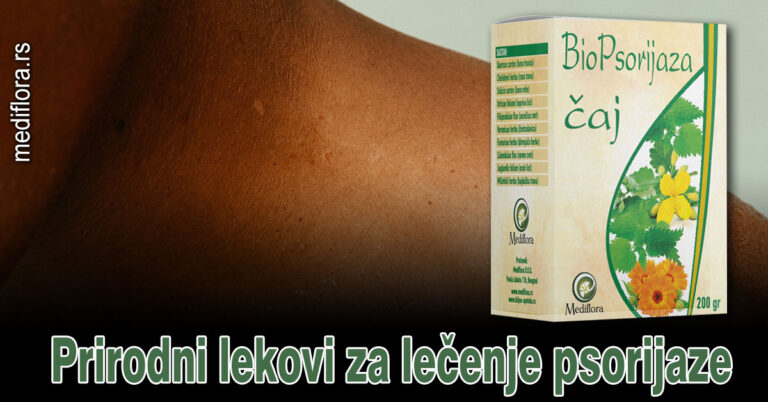 Prirodni-lekovi-za-lečenje-psorijaze Prirodni lekovi za lečenje psorijaze