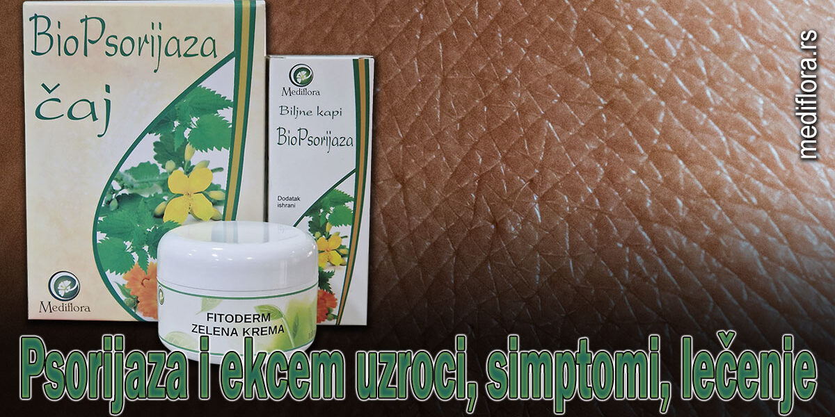 Psorijaza i ekcem uzroci, simptomi, lečenje