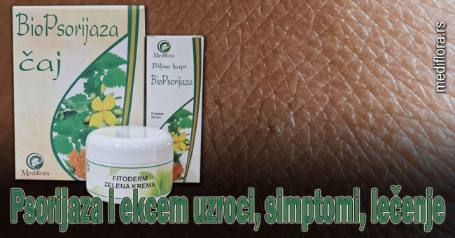 Psorijaza i ekcem uzroci, simptomi, lečenje