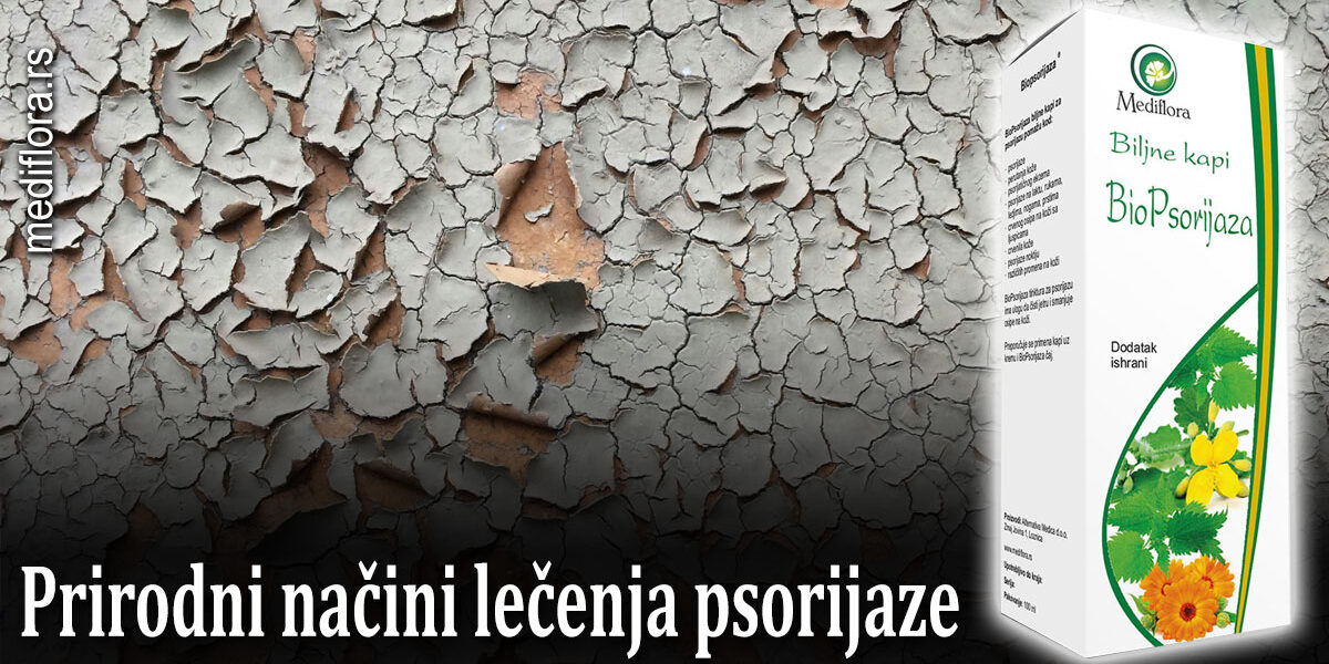 Prirodni-načini-lečenja-psorijaze Prirodni načini lečenja psorijaze
