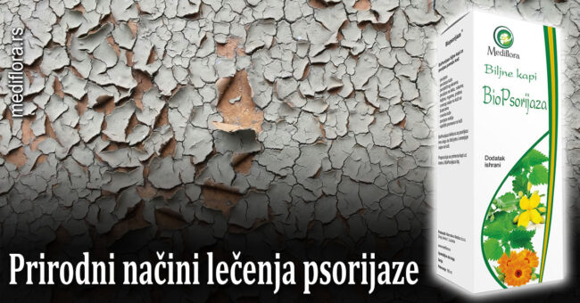 Prirodni načini lečenja psorijaze
