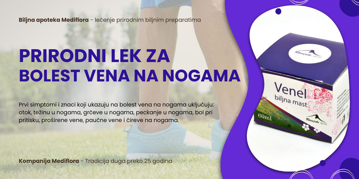 Prirodni-lek-za-bolest-vena-na-nogama Prirodni lek za bolest vena na nogama