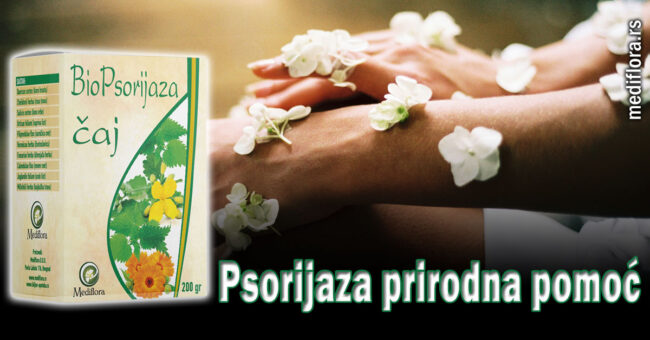 Psorijaza prirodna pomoć