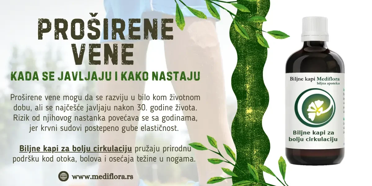 Proširene vene - kada se javljaju i kako nastaju