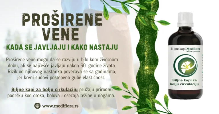 Proširene vene - kada se javljaju i kako nastaju