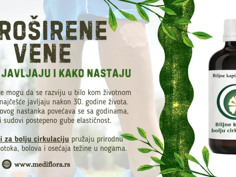 Proširene vene - kada se javljaju i kako nastaju